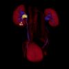 CT 3D njure 2 av Torbjrn Ahl